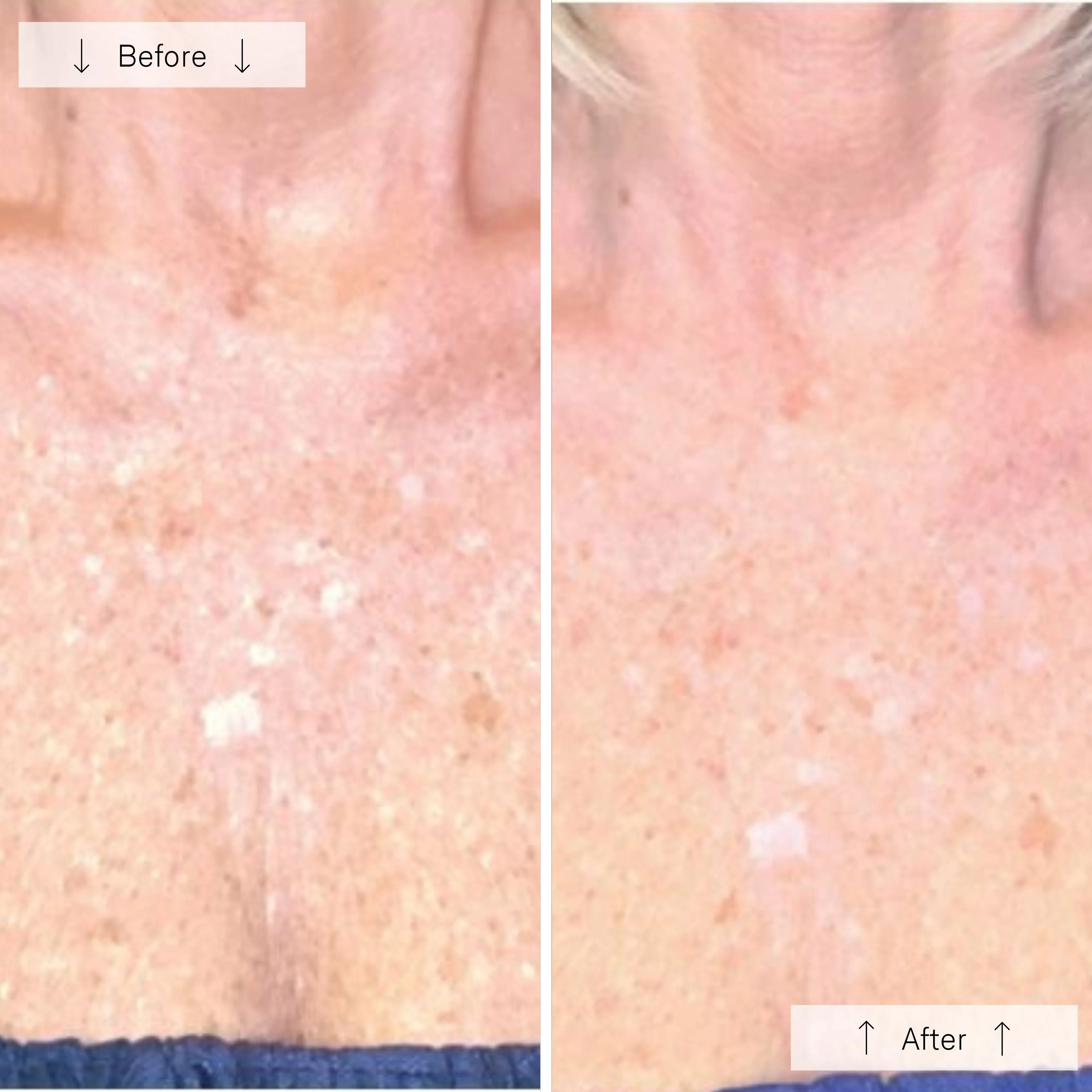 OmniLux Contour LED Mask Neck & Décolleté - Image 8