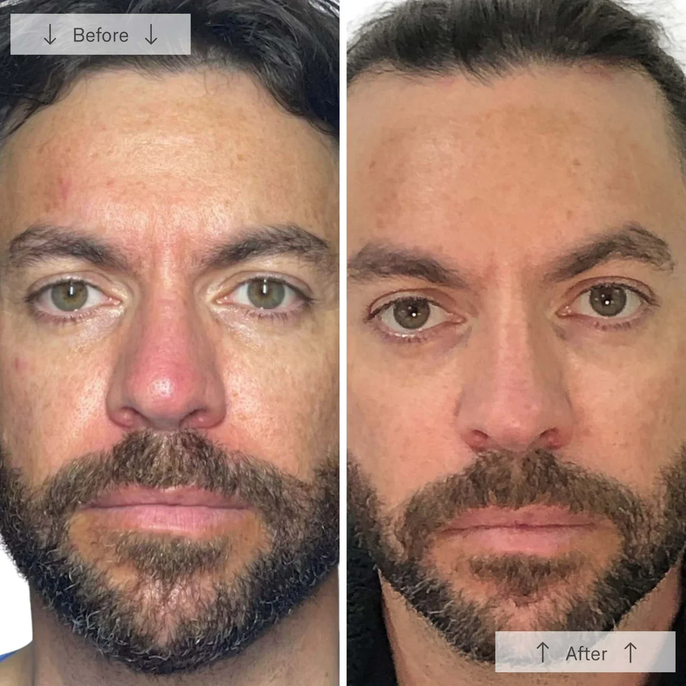 OmniLux Men LED Mask - Image 7