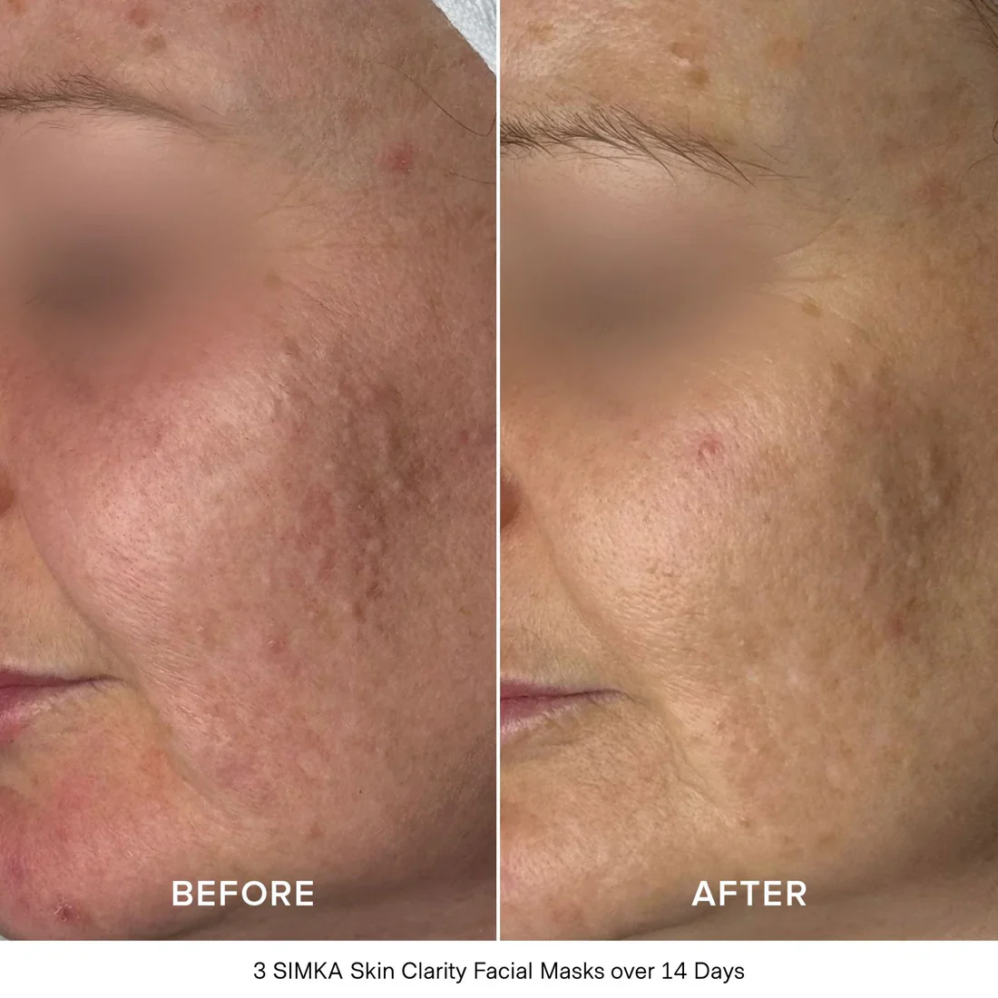 Skin Clarity Bio-Cellulose Facial Mask - Image 3