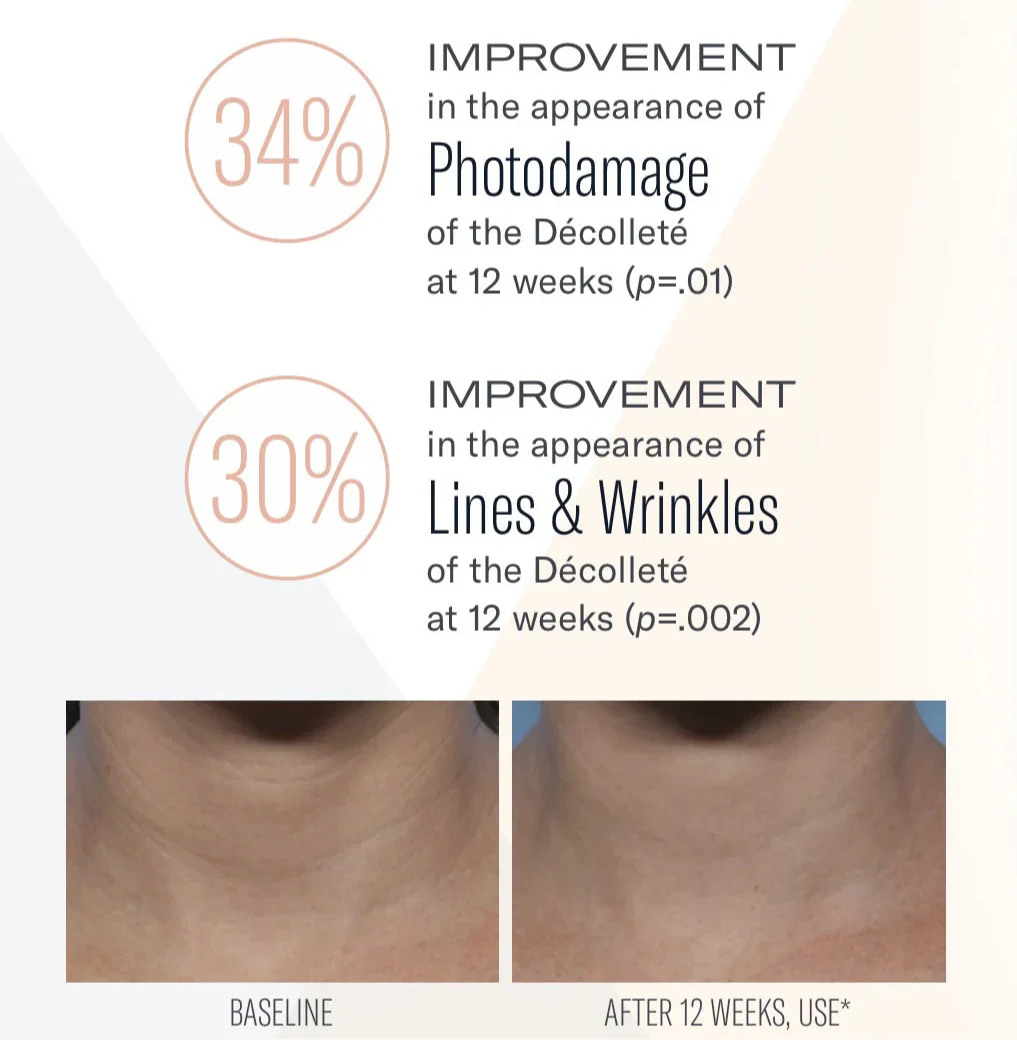 Techno Neck Perfecting Cream 50ml - Image 4