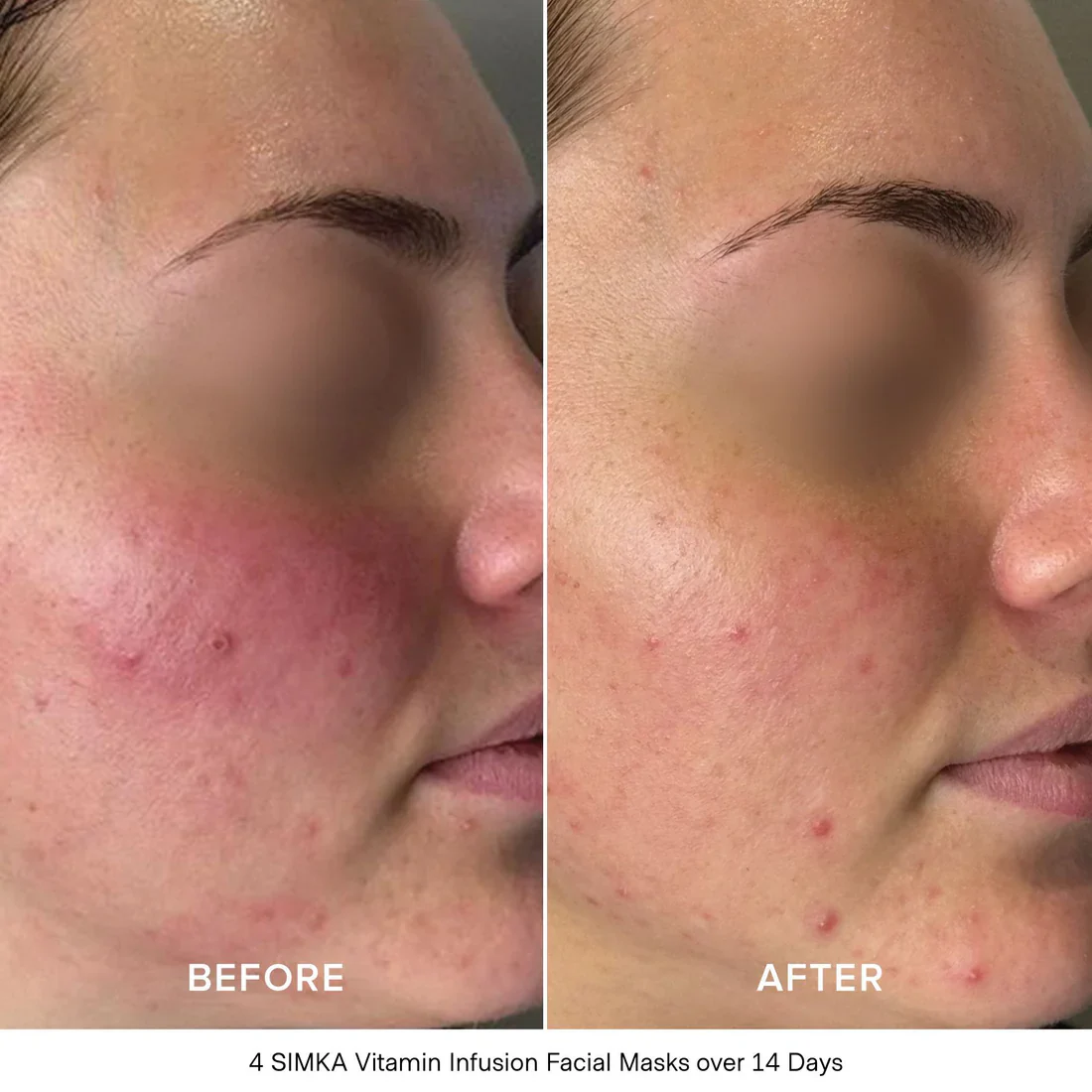 Vitamin Infusion Bio-Cellulose Facial Mask - Image 4